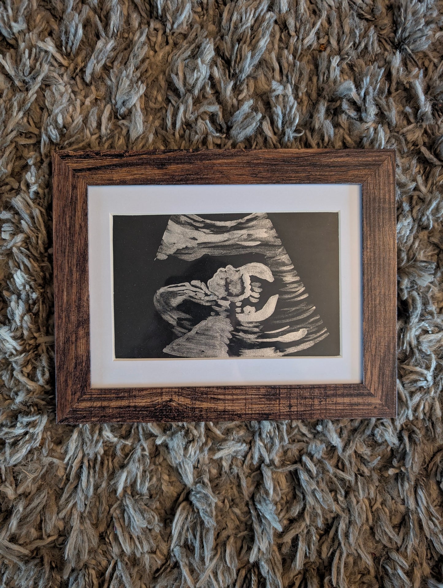 Ultrasound Painting