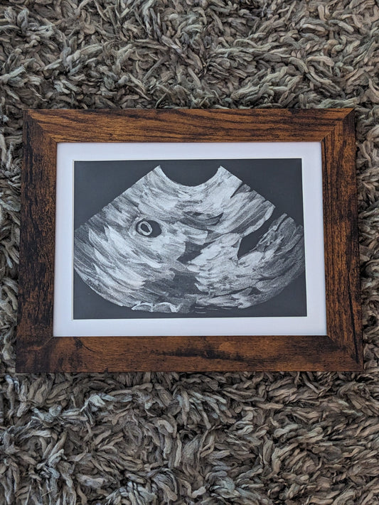 Custom Ultrasound Painting